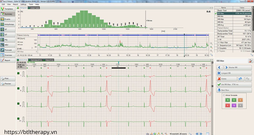 BTL Cardiopoint H100