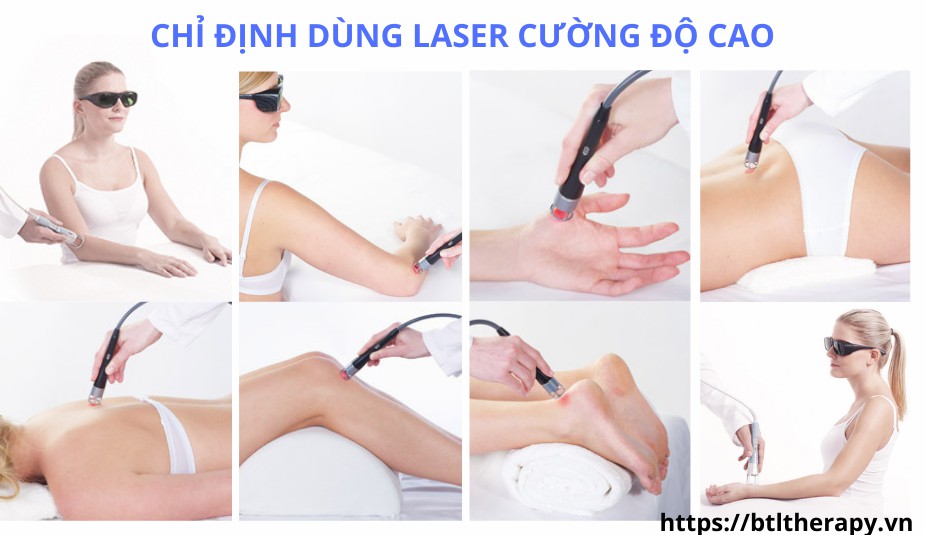 Chống chỉ định dùng Laser cường độ cao Chống chỉ định dùng Laser cường độ cao