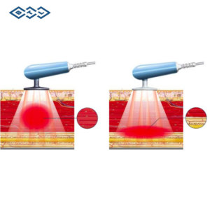 Máy Điều Trị Sóng Tần Số Radio BTL 6000 TR Therapy Elite