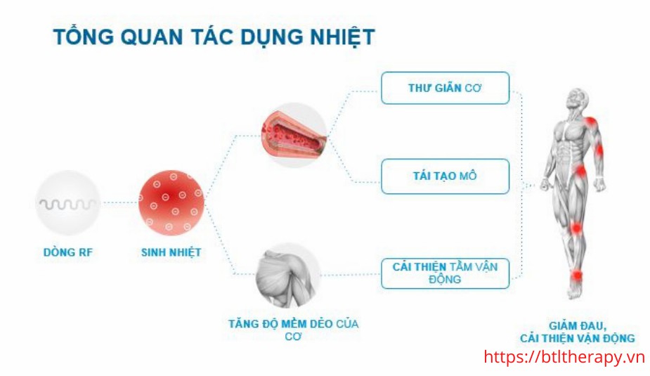 Tác dụng nhiệt của máy điều trị sóng tần số radio Tác dụng nhiệt của máy điều trị sóng tần số radio