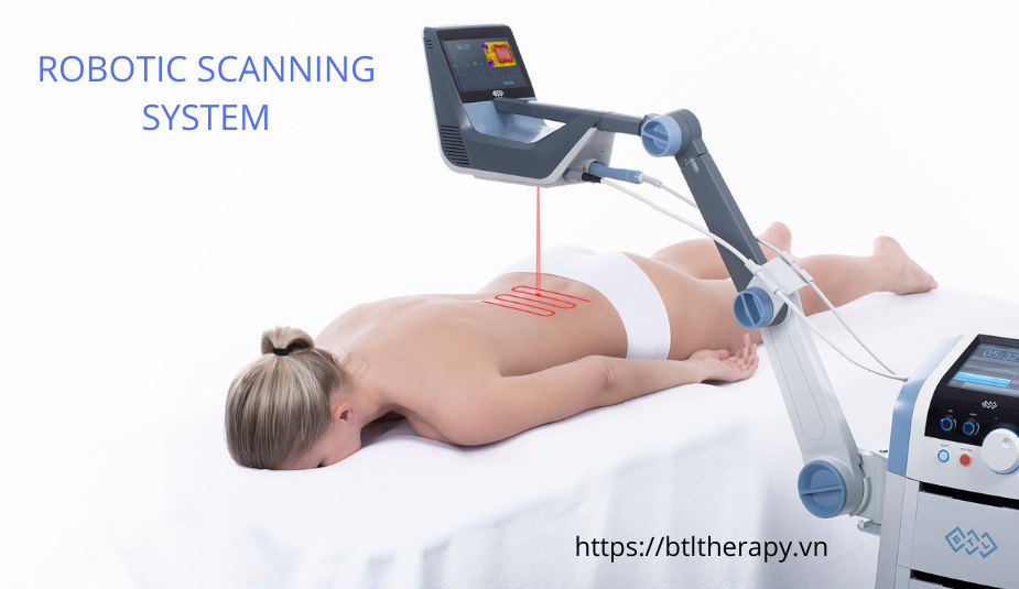 Laser Cường Độ Cao BTL 6000 30W