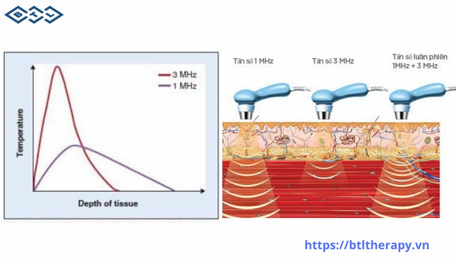 Tác Dụng Của Sóng Siêu Âm Đa Tần Tác Dụng Của Sóng Siêu Âm Đa Tần