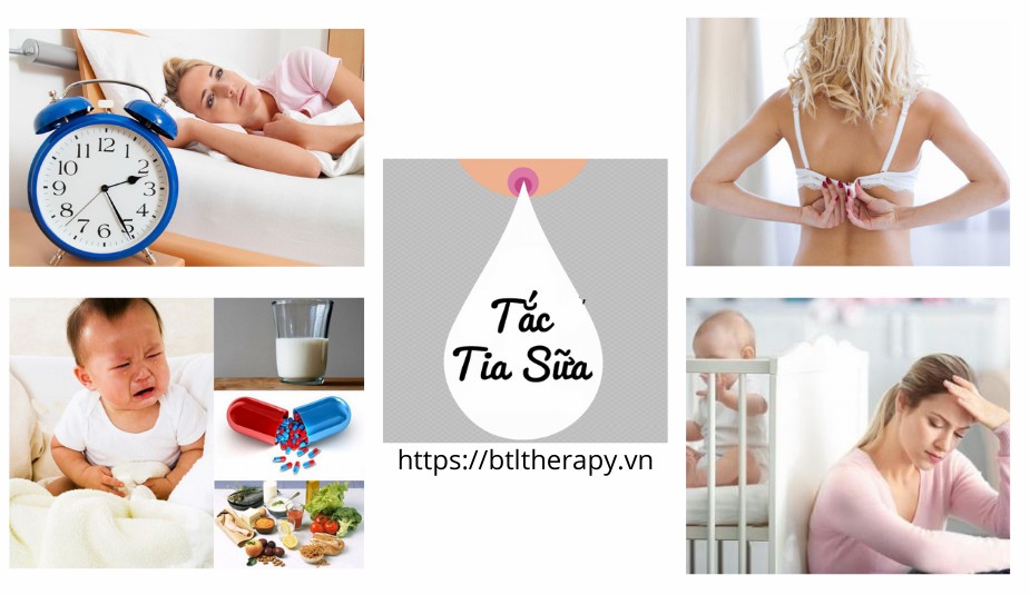 Nguyên nhân chính dẫn đến tắc tia sữa Nguyên nhân chính dẫn đến tắc tia sữa