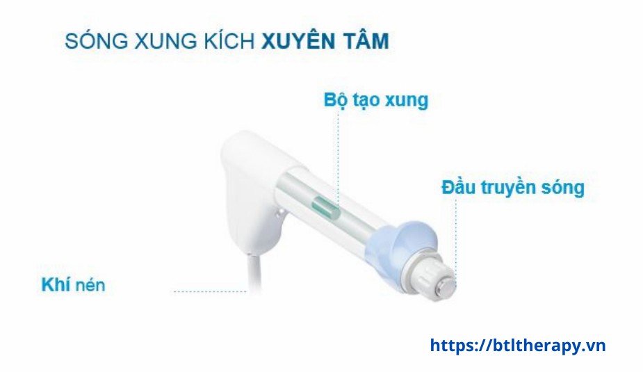 Máy Xung Kích Điều Trị BTL 6000 SWT EASY Máy Xung Kích Điều Trị BTL 6000 SWT EASY