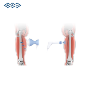 xung kich tri lieu btl 6000