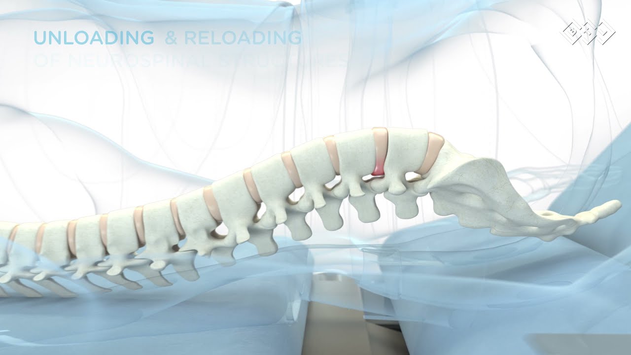 btl spinal decompression mechanism of action