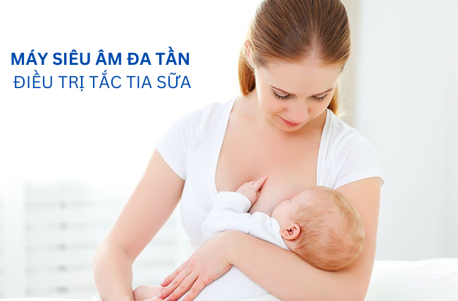 Điều Trị Tắc Tia Sữa Bằng Máy Siêu Âm Đa Tần