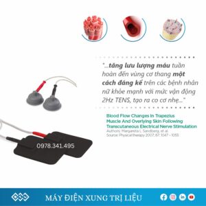 phu-kien-may-dien-xung-tri-lieu