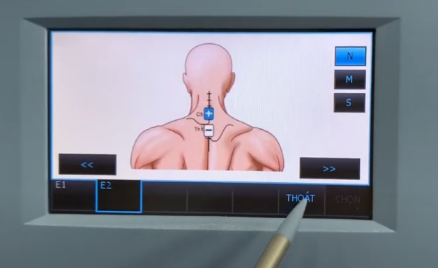 giao dien man hinh may dien xung tri lieu 2