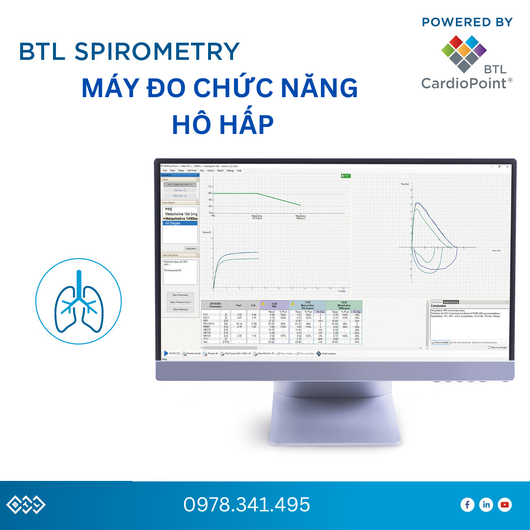 Máy đo chức năng hô hấp BTL Spiro