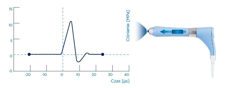 nguyen-ly-hoat-dong-cua-song-xung-kich